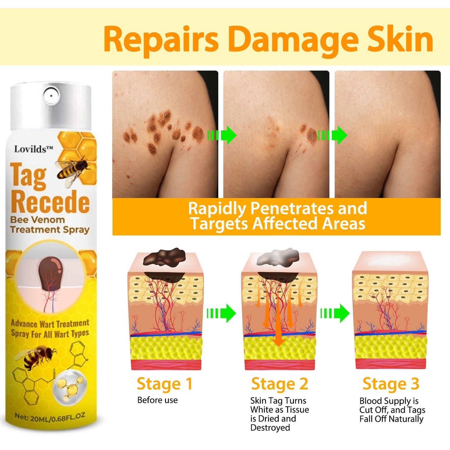 šLOVILDS⢠TagRecede Bee Venom Treatment Spray