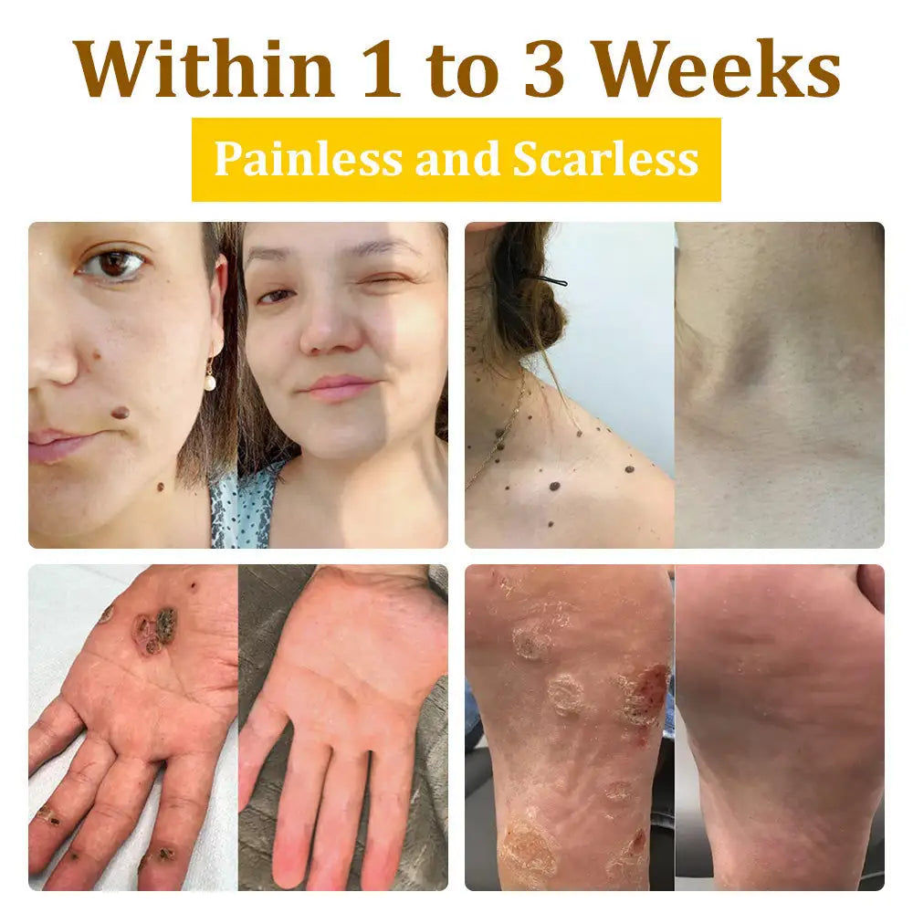 šLOVILDS⢠TagRecede Bee Venom Treatment Spray