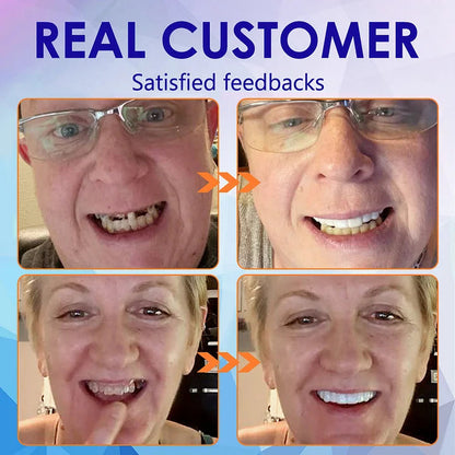 NESLEMY™🦷Advanced Customized Full Denture Set🦷 (⏰Limited time discount last 30 minutes⏰)