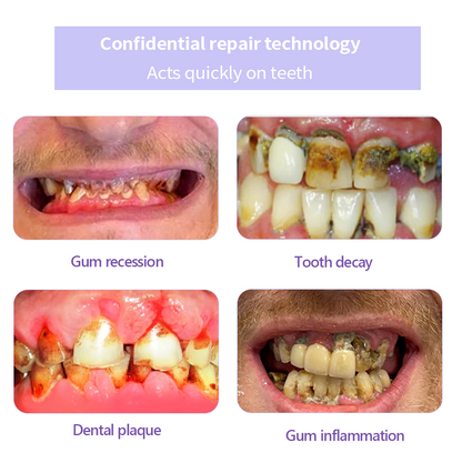 BBOJI™ (ADA recommended)Teeth Restoration Mineral Powder💎(𝐋𝐢𝐦𝐢𝐭𝐞𝐝 𝐭𝐢𝐦𝐞 𝐝𝐢𝐬𝐜𝐨𝐮𝐧𝐭 𝐋𝐚𝐬𝐭 𝟑𝟎 𝐦𝐢𝐧𝐮𝐭𝐞𝐬⏰)