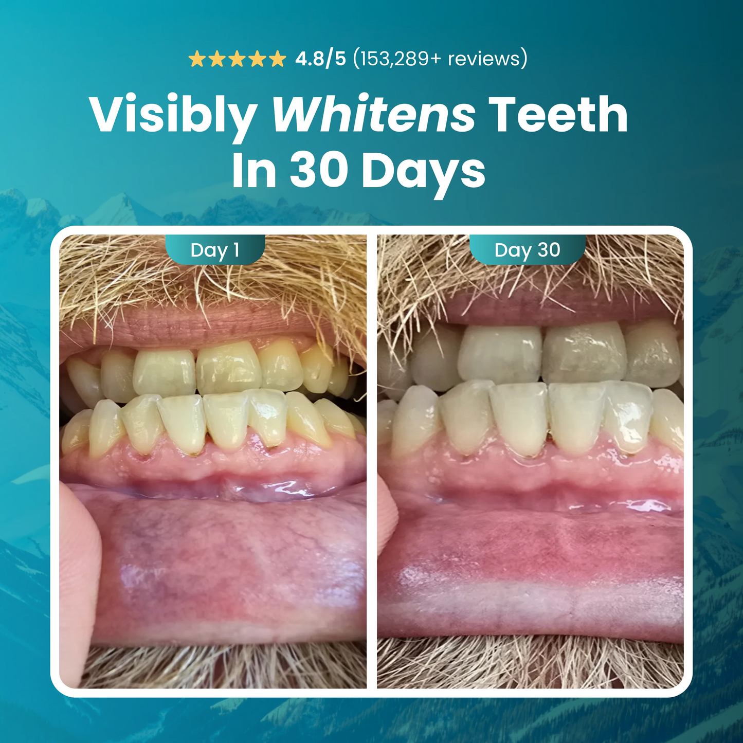 Juxek™ Remineralizing Gum